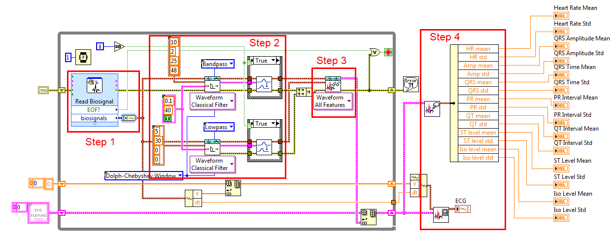 Write ECG 1.PNG